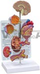 Hypertension Model - mini brain, eye, heart, kidney and artery models (patient education card included)